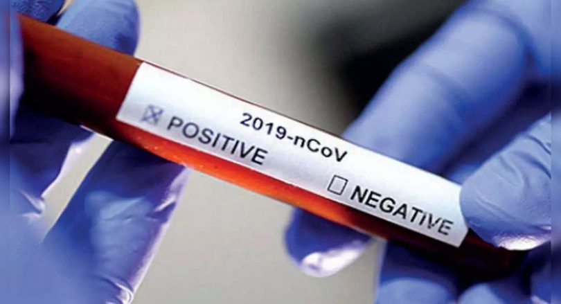 2 police contract Covid attended a public meeting CM KCR