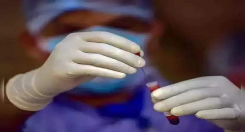 There are no active Covid cases in 23 Uttar Pradesh Districts