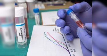 Thiruvananthapuram: The level of high testing of high tests in Mudakkal Panchayat causes concern