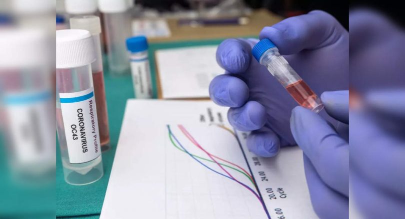 Thiruvananthapuram: The level of high testing of high tests in Mudakkal Panchayat causes concern