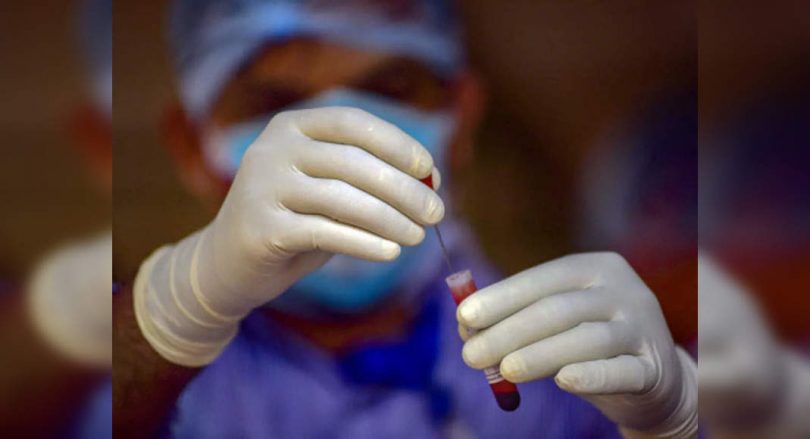 322 New Covid Cases in Telangana, 3 Deaths