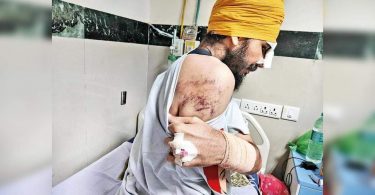3 farmers get stitches, someone loses vision after lathicharge