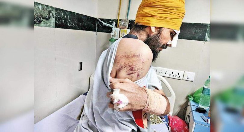 3 farmers get stitches, someone loses vision after lathicharge