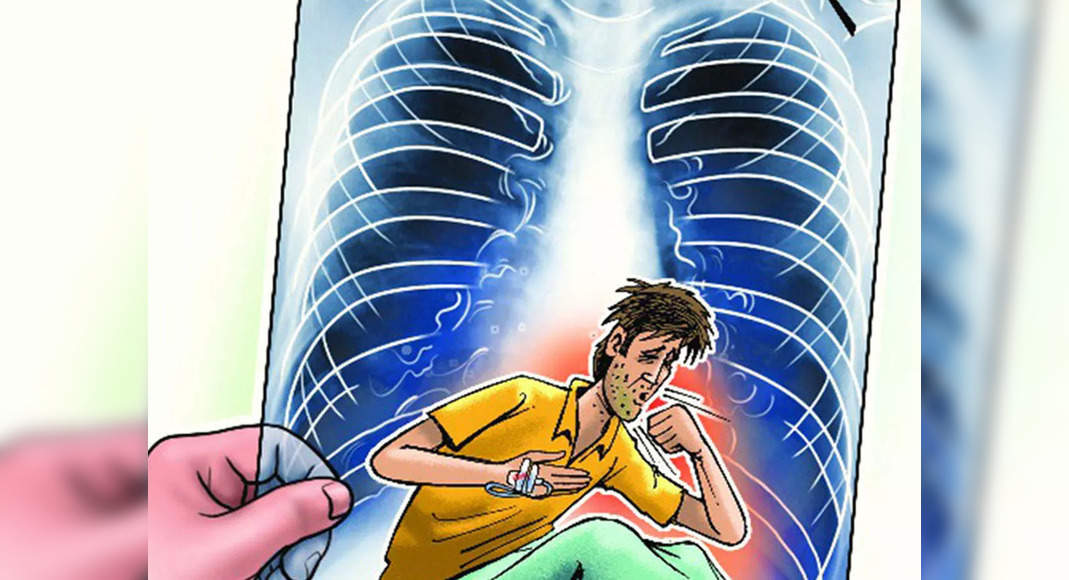 Dakshina Kannada saw a TB case increase, Mangalore was most affected